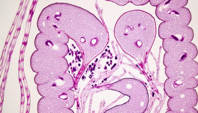 Diagram of polyps