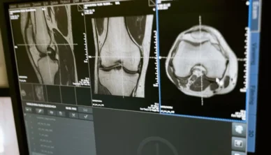 knee xray